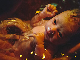 Childbirth - Post natal - water birth
