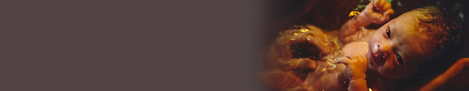 Childbirth - Post natal - water birth