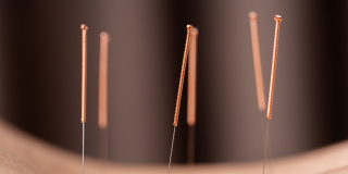 Acupuncture fertility