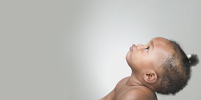 toddler - development - eye problems